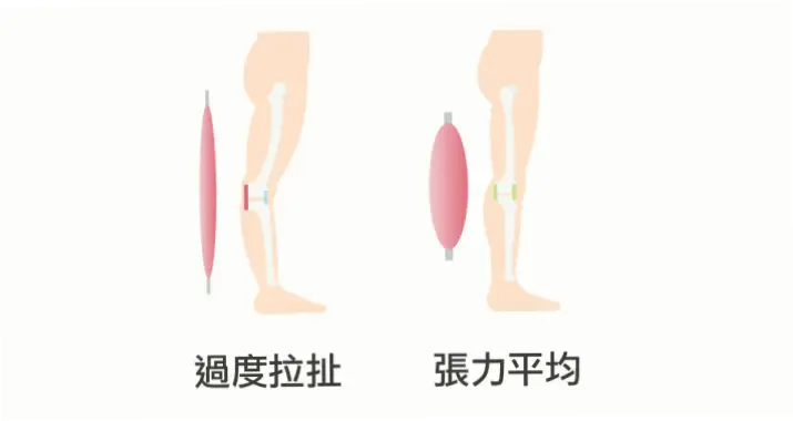膝盖微曲为何重要？过低反拖慢移动速度